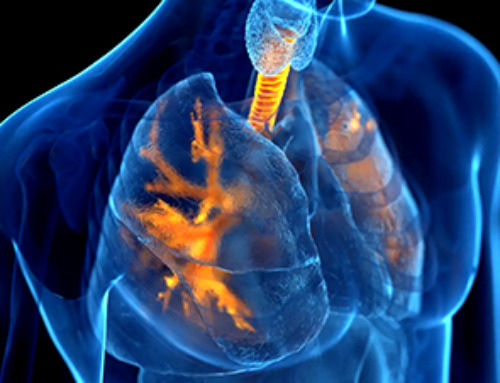 Inhalable nanoparticles could help treat chronic lung disease